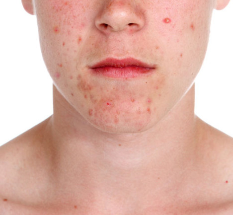 cosmetic concerns amp conditions we treat dermatology cosmetic concerns amp conditions we treat dermatology
