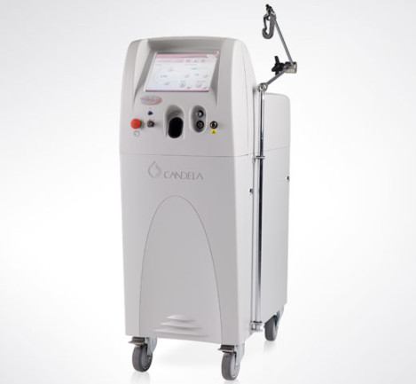 Vbeam Laser System Photo