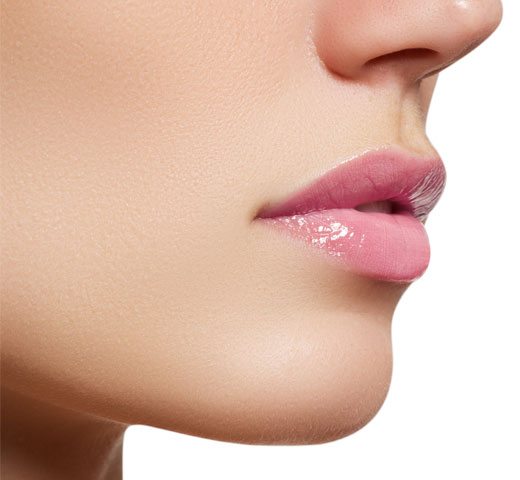 model for Juvederm Volbella lip injections