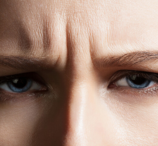 Frown Lines Clinical Trial