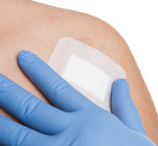 wound dressing