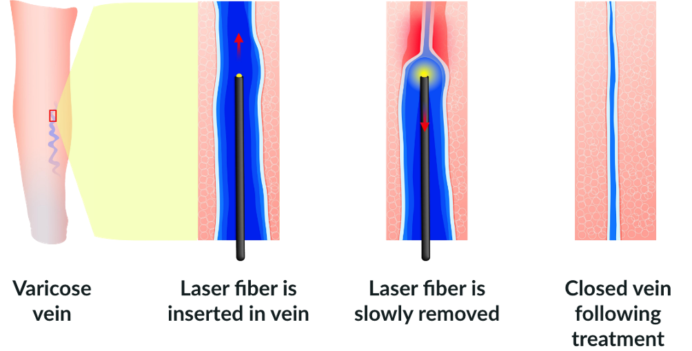 Vein Clinic Image